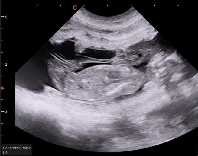 Ultrasound image from a French Bulldog.